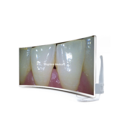 Dental LED Monitor Intraoral Camera High Resolution All-In-One Dental Endoscope Camera Video Recording System