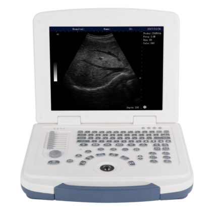 Ultrasound Scanner 12.1 inch LED Medical Display Used In abdomen, Urology, Obstetrics, Gynecology, Pediatrics